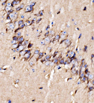 Anti-GPR54/KISS1R Antibody