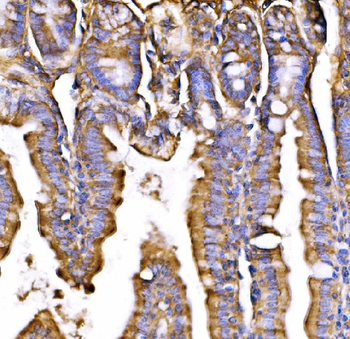 Anti-GPR54/KISS1R Antibody