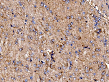 Anti-GPR54/KISS1R Antibody