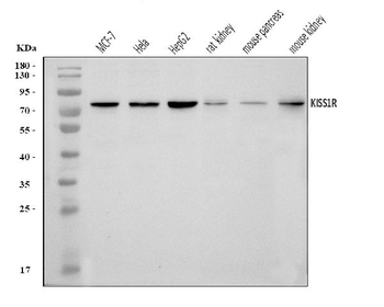 Anti-GPR54/KISS1R Antibody