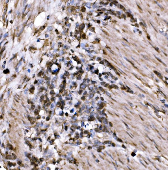 Anti-KLF15 Antibody