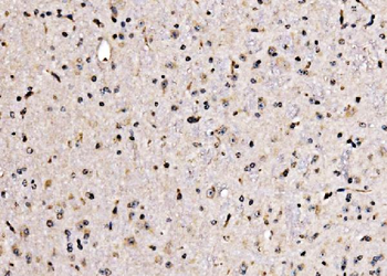 Anti-KLF15 Antibody