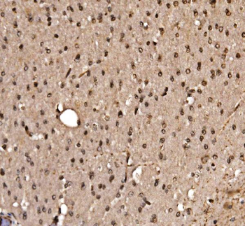 Anti-KLF15 Antibody