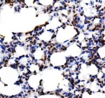 Anti-KLF15 Antibody
