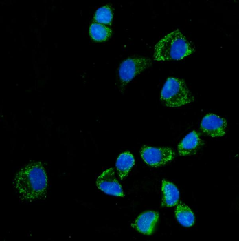 Anti-KLHL12 Antibody