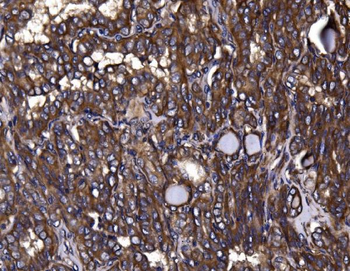 Anti-KLHL12 Antibody