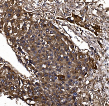 Anti-KLHL12 Antibody
