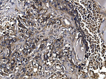 Anti-KLHL12 Antibody