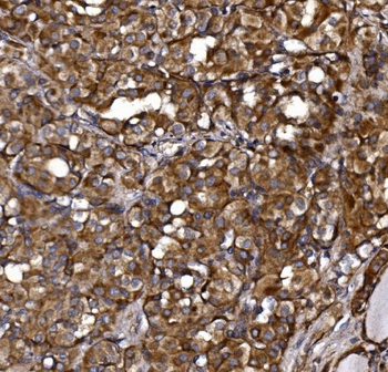 Anti-KLHL12 Antibody