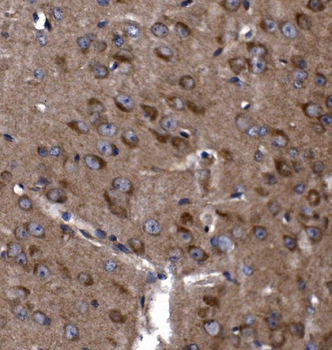 Anti-KLHL12 Antibody