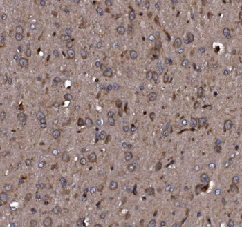 Anti-KLHL12 Antibody