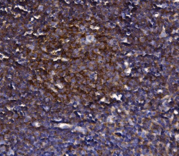 Anti-KLHL12 Antibody