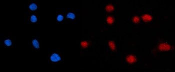 Anti-KPNB1 Antibody