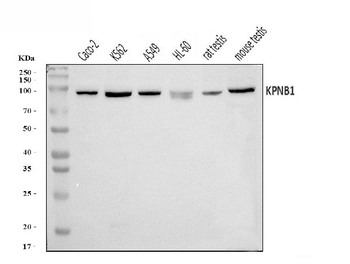 Anti-KPNB1 Antibody