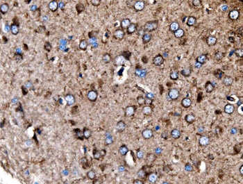 Anti-MDH2 Antibody