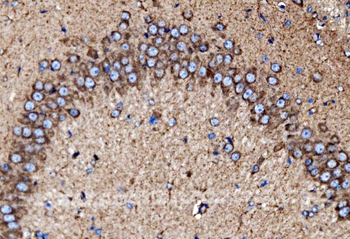 Anti-MDH2 Antibody