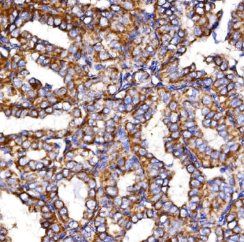 Anti-MDH2 Antibody