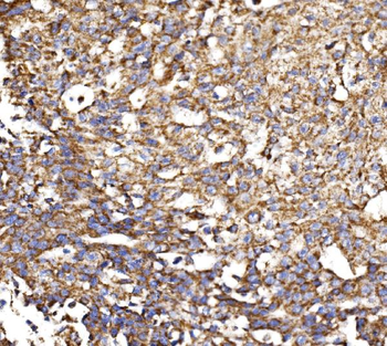 Anti-MDH2 Antibody