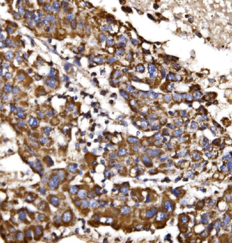 Anti-MDH2 Antibody