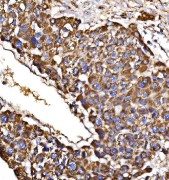 Anti-MDH2 Antibody