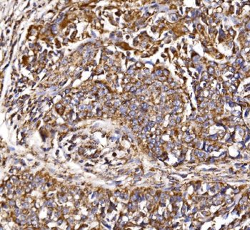 Anti-MDH2 Antibody