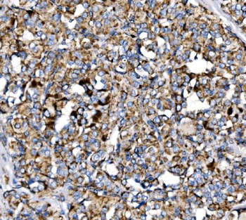 Anti-MDH2 Antibody