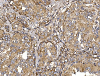 Anti-Pyrin/MEFV Antibody