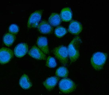 Anti-MLX-interacting protein/MLXIP Antibody