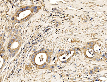 Anti-MLX-interacting protein/MLXIP Antibody