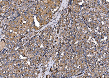 Anti-MLX-interacting protein/MLXIP Antibody