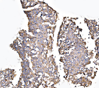 Anti-MLX-interacting protein/MLXIP Antibody
