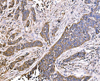 Anti-MLX-interacting protein/MLXIP Antibody