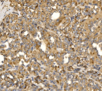 Anti-MLX-interacting protein/MLXIP Antibody