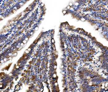 Anti-MLX-interacting protein/MLXIP Antibody