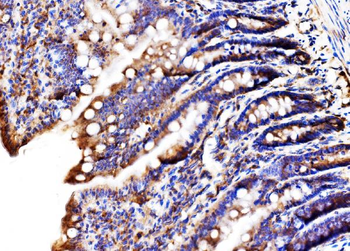 Anti-MLX-interacting protein/MLXIP Antibody