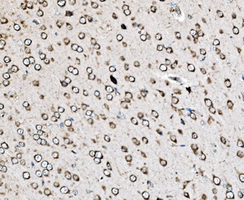 Anti-MRPS25 Antibody
