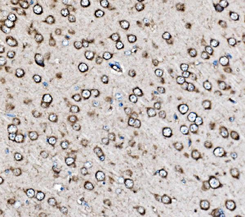 Anti-MRPS25 Antibody