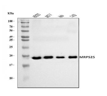 Anti-MRPS25 Antibody