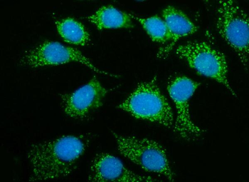 Anti-MRPS25 Antibody
