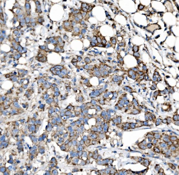 Anti-MRPS25 Antibody