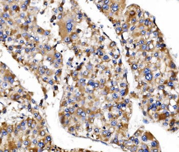 Anti-MRPS25 Antibody