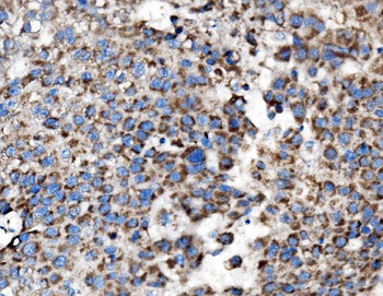 Anti-MRPS25 Antibody