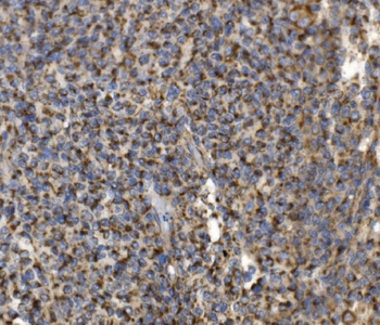 Anti-MRPS25 Antibody