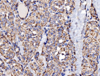 Anti-MRPS25 Antibody