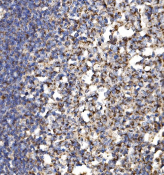 Anti-MRPS25 Antibody