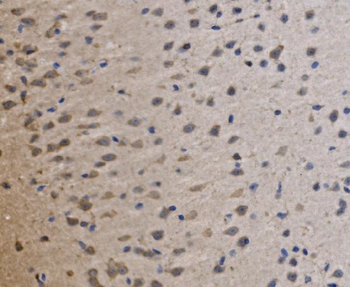 Anti-MRPS25 Antibody