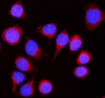 Nicastrin/NCSTN Antibody