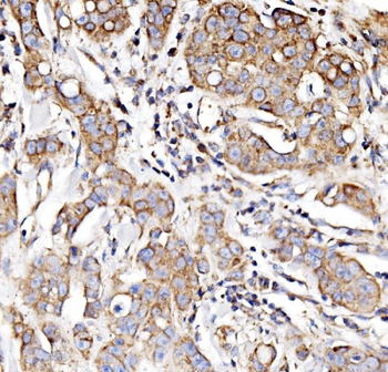 Anti-NDUFAF1 Antibody