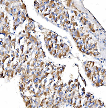 Anti-NDUFAF1 Antibody