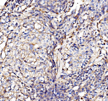 Anti-NDUFAF1 Antibody